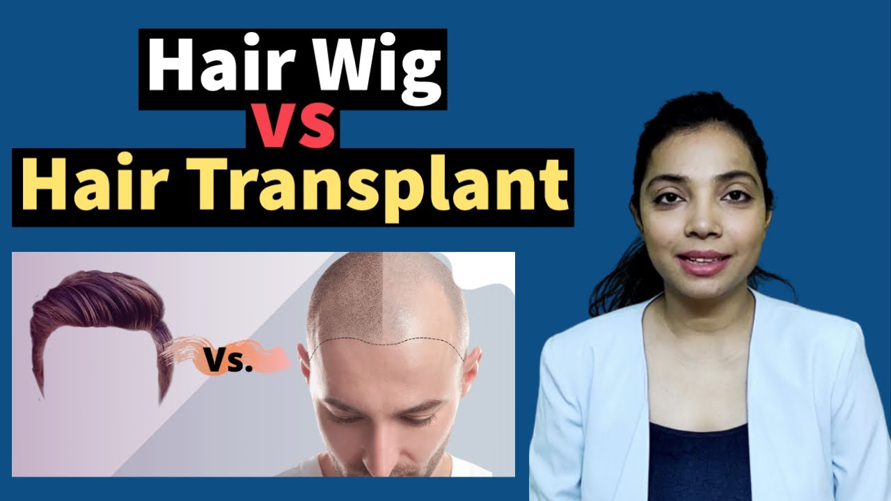 hair wig vs hair transplant